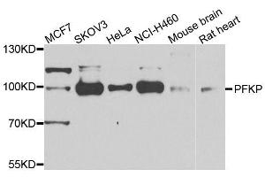 Western blot analysis of extracts of various cell lines, using PFKP antibody. (PFKP 抗体)