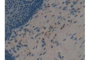 Detection of APOF in Human Esophagus Tissue using Polyclonal Antibody to Apolipoprotein F (APOF) (Apolipoprotein F 抗体  (AA 122-307))