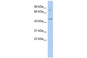 FBXO39 antibody used at 1 ug/ml to detect target protein. (FBXO39 抗体  (N-Term))