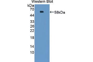 Western Blotting (WB) image for anti-Activin Receptor Type 1C (ACVR1C) (AA 21-493) antibody (ABIN5013073)
