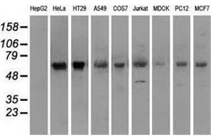 Western blot analysis of extracts (35 µg) from 9 different cell lines by using anti-SILV monoclonal antibody. (Melanoma gp100 抗体)