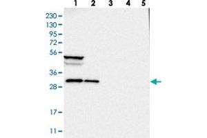 Western blot analysis of Lane 1: RT-4, Lane 2: U-251 MG, Lane 3: Human Plasma, Lane 4: Liver, Lane 5: Tonsil with SBDS polyclonal antibody  at 1:250-1:500 dilution. (SBDS 抗体)