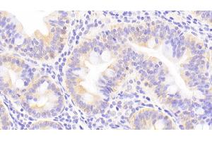 Detection of MT2 in Human Small intestine Tissue using Polyclonal Antibody to Metallothionein 2 (MT2) (MT2 抗体  (AA 2-61))