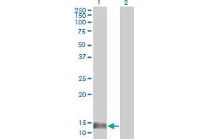 Western Blotting (WB) image for anti-Macrophage Migration Inhibitory Factor (Glycosylation-Inhibiting Factor) (MIF) (AA 1-115) antibody (ABIN561823)