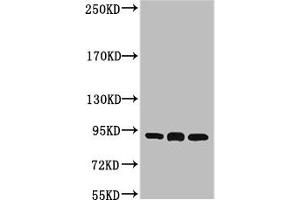 Western blot analysis of 1) Hela, 2) Mouse Brain tissue, 3) Rat Brain tissue, diluted at 1:2000. (HSP9AB1 抗体)