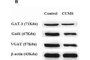 Western Blotting (WB) image for anti-Actin, beta (ACTB) antibody (ABIN3020544)