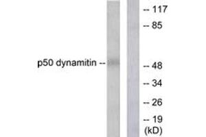 Western blot analysis of extracts from A549 cells, using p50 Dynamitin Antibody. (Dynamitin 抗体  (AA 341-390))