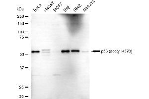 Western blotting analysis using p53 (acetyl K370) antibody (ABIN7800682).