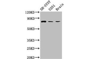 Western Blot Positive WB detected in: SH-SY5Y whole cell lysate, U251 whole cell lysate, Rat brain tissue All lanes: NCDN antibody at 2. (NCDN 抗体  (AA 403-516))