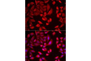 Immunofluorescence analysis of HeLa cells using CCT2 antibody (ABIN5973929). (CCT2 抗体)