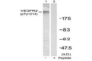 Image no. 2 for anti-VEGF Receptor 2 (VEGFR2) (pTyr1214) antibody (ABIN196768) (VEGFR2/CD309 抗体  (pTyr1214))