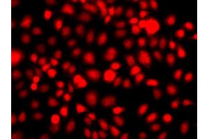 Immunofluorescence analysis of A549 cells using NR2E1 antibody (ABIN6290680). (NR2E1 抗体)