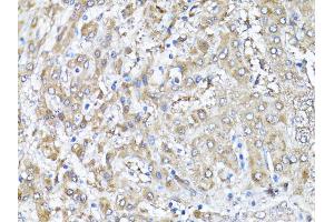 Immunohistochemistry of paraffin-embedded human liver using SNAI1 antibody (ABIN4905248) at dilution of 1:100 (40x lens).