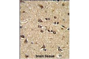 Immunohistochemistry (Paraffin-embedded Sections) (IHC (p)) image for anti-Ras Interacting Protein 1 (RASIP1) (AA 651-678) antibody (ABIN390856)