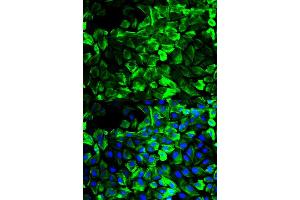 Immunofluorescence analysis of HeLa cell using TPM1 antibody. (Tropomyosin 抗体)