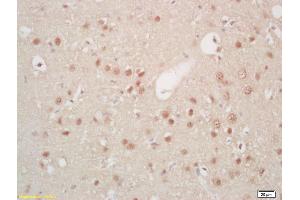 Formalin-fixed and paraffin embedded rat brain labeled with Rabbit Anti Hes5 Polyclonal Antibody, Unconjugated (ABIN703811) at 1:200 followed by conjugation to the secondary antibody and DAB staining (HES5 抗体  (AA 21-120))