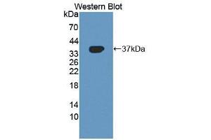 Western blot analysis of the recombinant protein. (BHMT 抗体  (AA 11-314))