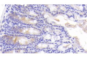 Detection of ICK in Mouse Colon Tissue using Polyclonal Antibody to Intestinal Cell Kinase (ICK) (ICK 抗体  (AA 1-284))