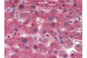 Liver, Human: Formalin-Fixed, Paraffin-Embedded (FFPE) (TTR 抗体)