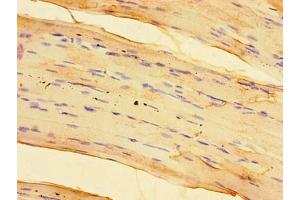Immunohistochemistry of paraffin-embedded human skeletal muscle tissue using ABIN7170581 at dilution of 1:100 (SPHK1 抗体  (AA 1-384))