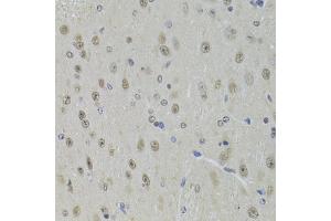 Immunohistochemistry of paraffin-embedded mouse brain using DDX1 Antibody (ABIN5973950) at dilution of 1/100 (40x lens). (DDX1 抗体)