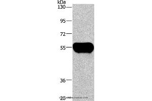 Western blot analysis of Human plasma tissue, using AHSG Polyclonal Antibody at dilution of 1:1350 (Fetuin A 抗体)