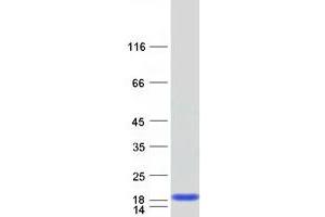 Validation with Western Blot