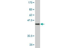 Western Blot detection against Immunogen (46. (CD3 epsilon 抗体  (AA 23-207))