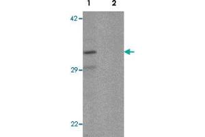 Western blot analysis of K562 cell lysate with CLEC2A polyclonal antibody  at 1 ug/mL in (1) the absence and (2) the presence of blocking peptide. (CLEC2A 抗体  (N-Term))