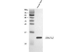 Western blot analysis of NDUFA2 using anti-NDUFA2 antibody (ABIN7602345).