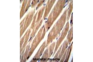 Immunohistochemistry (IHC) image for anti-Phosphatidylinositol-4-Phosphate 5-Kinase-Like 1 (PIP5KL1) antibody (ABIN2996126) (PIP5KL1 抗体)