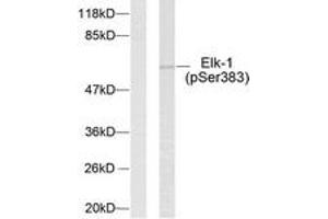 Western blot analysis of extracts from HeLa cells treated with UV, using Elk1 (Phospho-Ser383) Antibody. (ELK1 抗体  (AA 351-400))