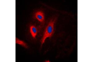 Immunofluorescent analysis of FADD staining in HeLa cells. (FADD 抗体  (Center))