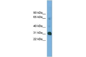 WB Suggested Anti-CCDC127 Antibody Titration: 0. (CCDC127 抗体  (N-Term))