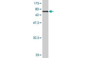 Western Blot detection against Immunogen (73. (ENO1 抗体  (AA 1-434))