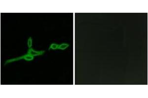 Immunofluorescence analysis of LOVO cells, using GPR15 Antibody. (GPR15 抗体  (AA 201-250))