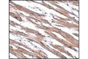 Immunohistochemistry of MAK10 in human heart tissue with this product at 2. (MAK10/NAA35 抗体  (N-Term))