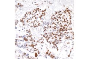 anti-Timeless Homolog (TIMELESS) (C-Term) antibody