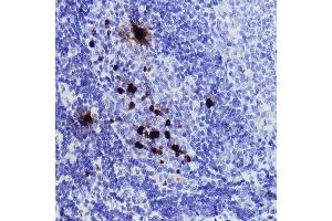 Immunohistochemistry of paraffin-embedded rat spleen using Phospho-Histone H3-S10 Rabbit pAb (ABIN7267687) at dilution of 1:2000 (40x lens).
