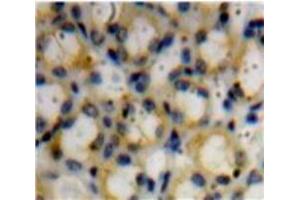 IHC-P analysis of Kidney tissue, with DAB staining. (Decorin 抗体  (AA 45-152))