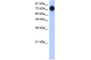 WB Suggested Anti-ZNF16 Antibody Titration:  0. (ZNF16 抗体  (N-Term))