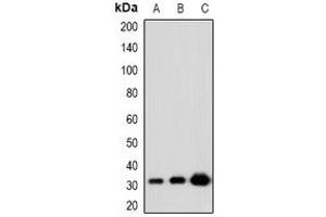 Western blot analysis of KLF13 (AcK166) expression in HeLa (A), NIH3T3 (B), PC12 (C) whole cell lysates. (KLF13 抗体  (acLys166))