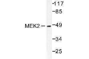 Image no. 1 for anti-Mitogen-Activated Protein Kinase Kinase 2 (MAP2K2) antibody (ABIN265519) (MEK2 抗体)