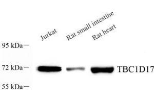 Western blot analysis of TBC1D17 (ABIN7075844) at dilution of 1: 1000 (TBC1D17 抗体)