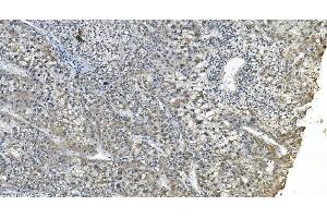 IHC analysis of eRF1/ETF1 using anti-eRF1/ETF1 antibody (ABIN7602625).