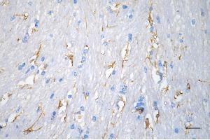 Immunohistochemistry was performed on paraffin-embedded mouse brain using desmin antibody (ABIN7798314), 1:200). (Recombinant Desmin 抗体)