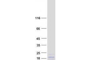 Western Blotting (WB) image for Ubiquinol-Cytochrome C Reductase Hinge Protein (Uqcrh) protein (Myc-DYKDDDDK Tag) (ABIN2735044)