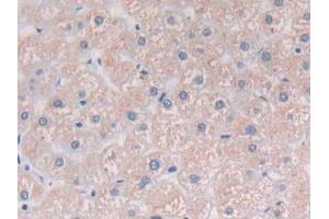 Detection of PLCg1 in Human Liver Tissue using Polyclonal Antibody to Phospholipase C Gamma 1 (PLCg1) (Phospholipase C gamma 1 抗体  (AA 1091-1290))