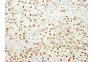 Immunohistochemistry (IHC) image for anti-MutS Homolog 6 (E. Coli) (MSH6) (AA 350-400) antibody (ABIN7448674)