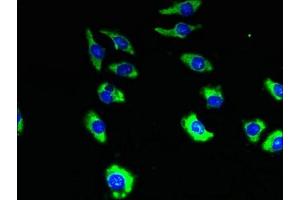 Immunofluorescent analysis of A549 cells using ABIN7173119 at dilution of 1:100 and Alexa Fluor 488-congugated AffiniPure Goat Anti-Rabbit IgG(H+L) (TMEM19 抗体  (AA 105-217))